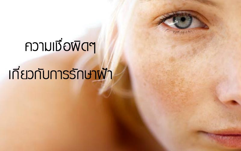 ความเชื่อผิดๆเกี่ยวกับการรักษาฝ้า