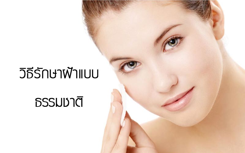 รักษาฝ้าด้วยวิธีธรรมชาติ
